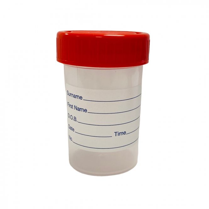 Hovedbilde Uringlass 60 ml